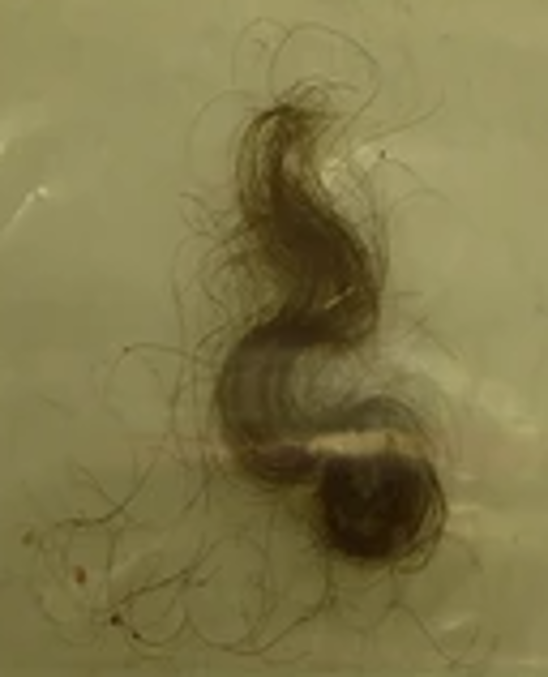 A soft-textured, wavy lock of hair belonging to a Kerma period individual excavated at Kadruka, Upper Nubia (northern Sudan). Ancient DNA analysis by Wang et al. (2022) has revealed that this specimen is genetically indistinguishable from the Cushites of the Early Pastoral Neolithic. (For more details, see Did the ancient Cushites have soft-textured hair?.)