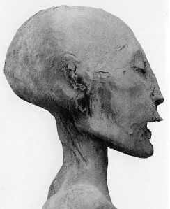 Mummy of the ancient Egyptian noblewoman "The Younger Lady," mother of the 18th Dynasty Pharaoh Tutankhamun. The Egyptologists Marianne Luban and Joanne Fletcher have identified this monarch as Nefertiti. Note her elongated skull caused by artificial cranial deformation, which some members of the ancient Egyptian Amarna royal family used to practice.