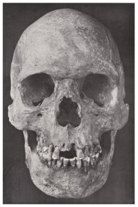 The Makalia skull, which belonged to an early Cushitic settler of the Pastoral Neolithic
