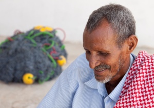 A Somali man with the amrani/mariin phenotype