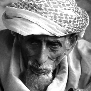 A Socotri man with the amrani/mariin phenotype.